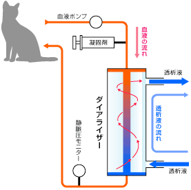 血液透析イラスト